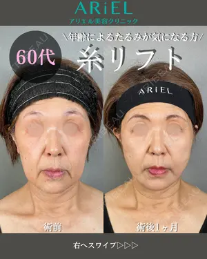30 days after image