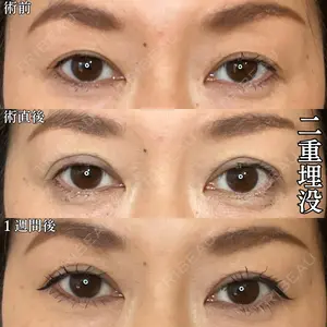 before image