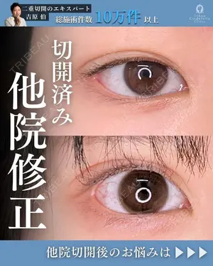 180 days after image