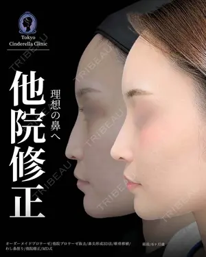 180 days after image