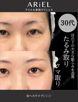 30 days after image