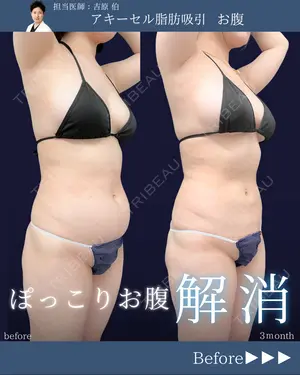 90 days after image