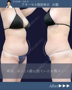 before image
