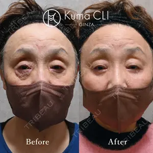 90 days after image