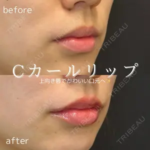 before image