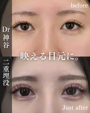 before image