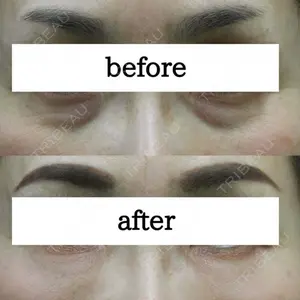 before image
