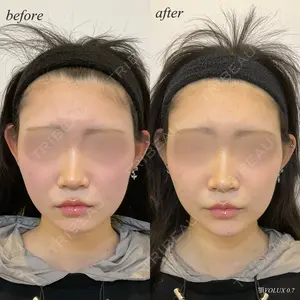 before image