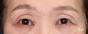 before image