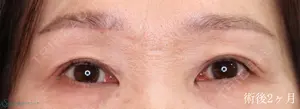 60 days after image