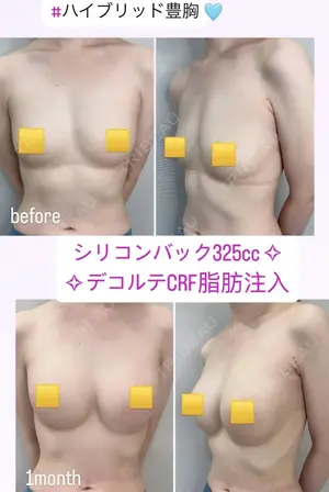 30 days after image