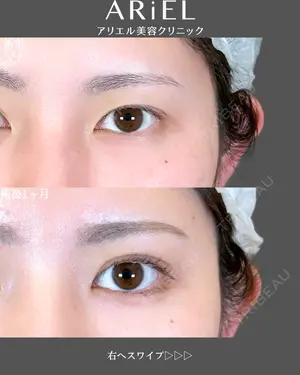 30 days after image