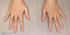 150 days after image