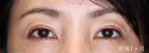 30 days after image