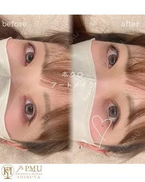 before image