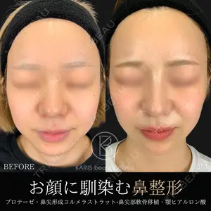 before image