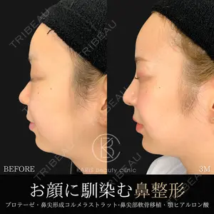 90 days after image