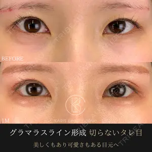 30 days after image
