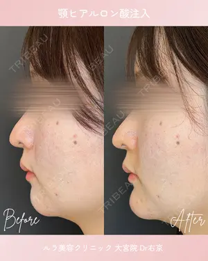 0 days after image