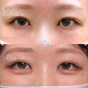 before image