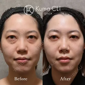 180 days after image