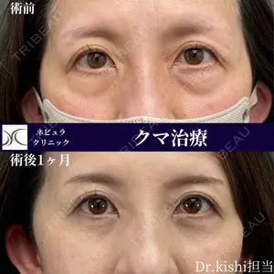 30 days after image