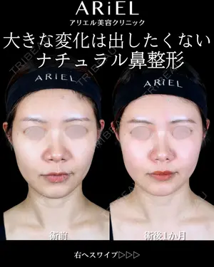 30 days after image