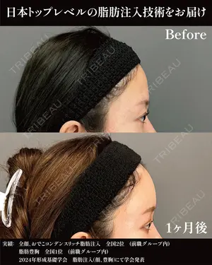 30 days after image