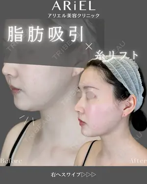 30 days after image