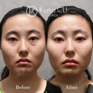 180 days after image