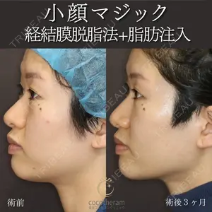 90 days after image