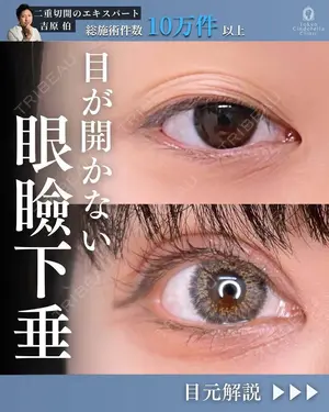 90 days after image