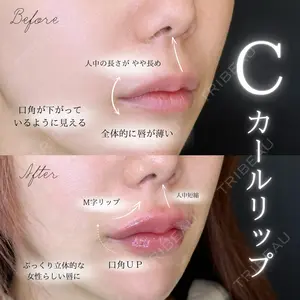 0 days after image