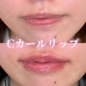 0 days after image