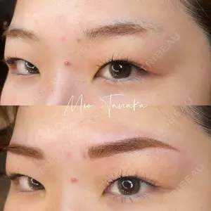 0 days after image