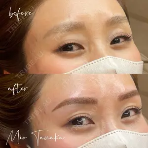 0 days after image