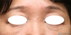 90 days after image