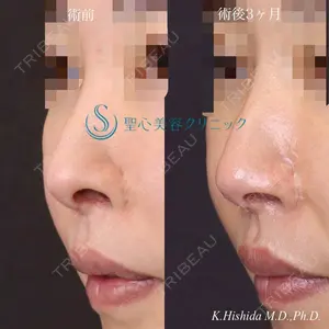 90 days after image