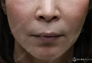 240 days after image
