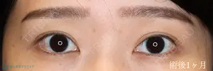 30 days after image