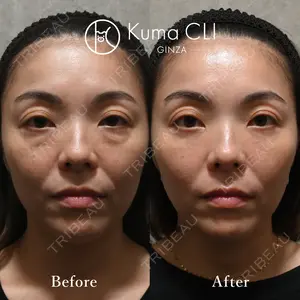 90 days after image