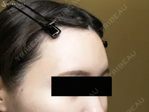 180 days after image
