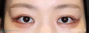 30 days after image