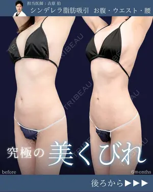 180 days after image