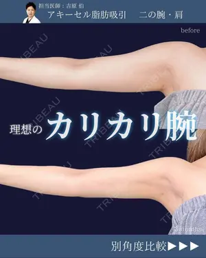 90 days after image