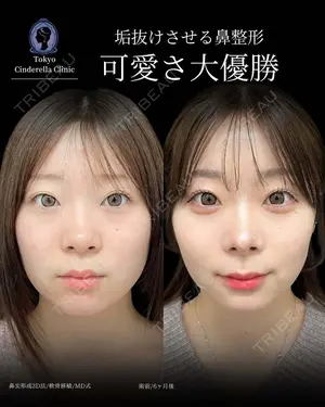 180 days after image