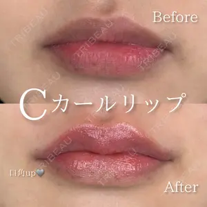 0 days after image