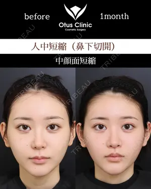 30 days after image