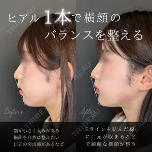 0 days after image