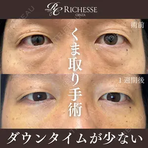 before image